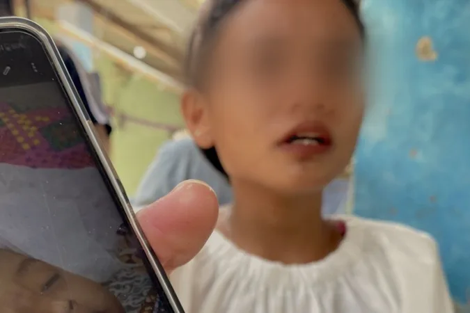 Diduga Dianiaya Pacar Ibunya, Balita 17 Bulan di Karawang Tewas